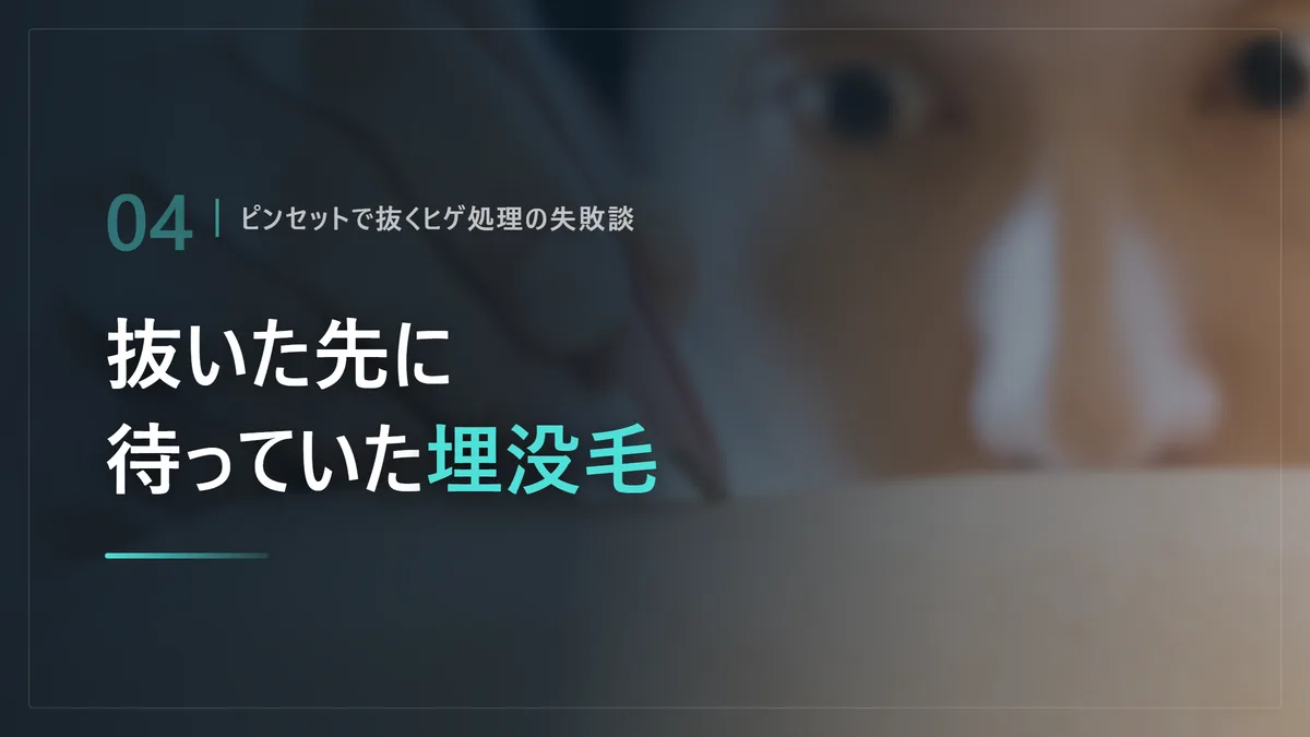 ピンセットでヒゲを抜く自己処理で埋没毛になった失敗談を示した画像