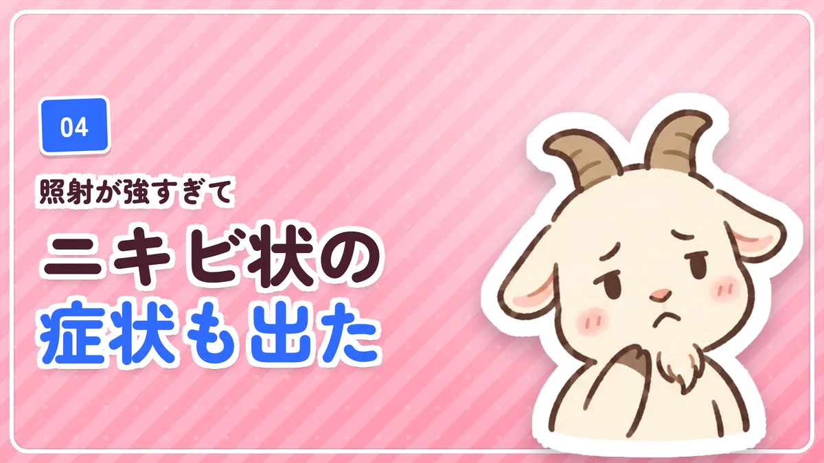 照射が強すぎてニキビのような症状が出たが数日で治まったことを示したバナー