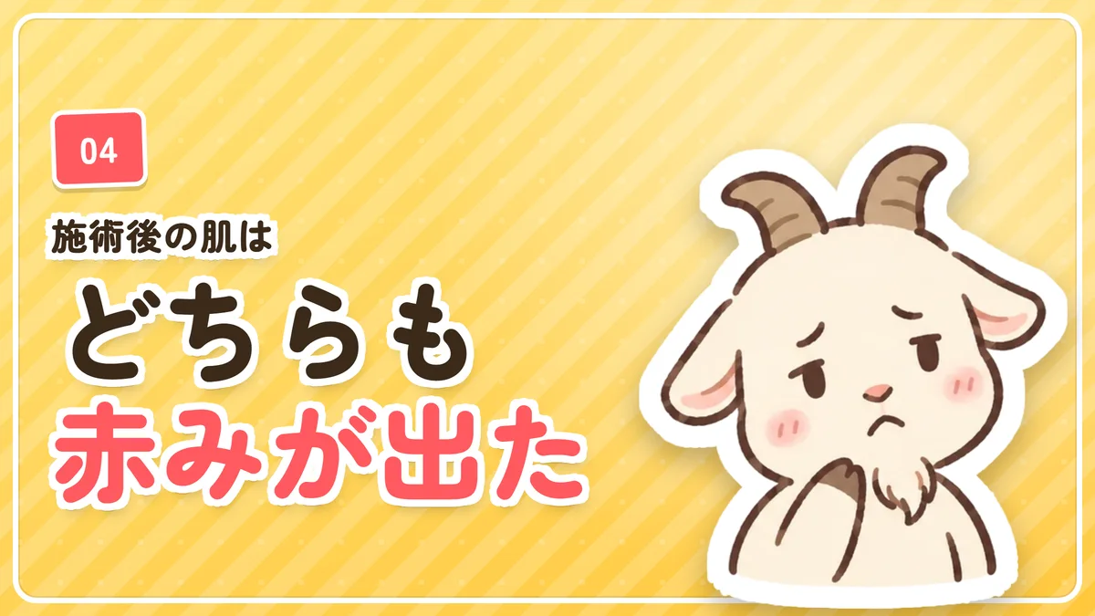 施術後の肌はヒゲも体も赤みが出たことを示したバナー